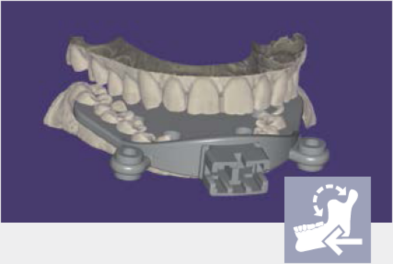 exocad - Jaw Motion Import Add On Module exocad by exocad- Unique Dental Supply Inc.