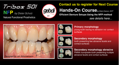 2 DAYS HANDS-ON COURSE by Brian Carson Efficient Denture Setups Using NFP Method (with Tribos 501 Teeth)