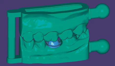 exocad - Chairside CAD Model Creator Module exocad by exocad- Unique Dental Supply Inc.