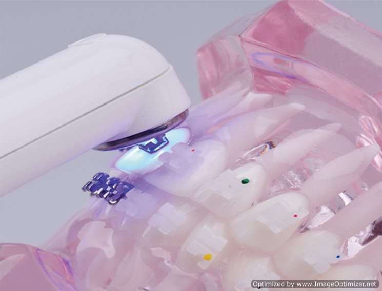 Xlite2 Cure - Curing Light - Flight Curing Light by Flight Dental Systems- Unique Dental Supply Inc.