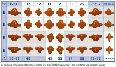 144 Prerformed Singles Pattern Wax by al dente- Unique Dental Supply Inc.