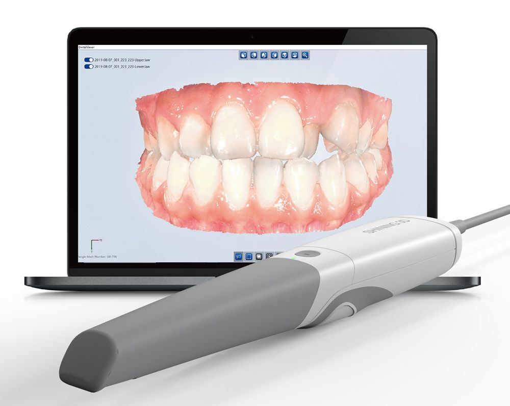 Shining3D Aoralscan Elite | Intraoral Photogrammetry Scanner