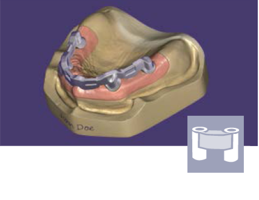 exocad - Bar Add On Module – Unique Dental Supply Inc.