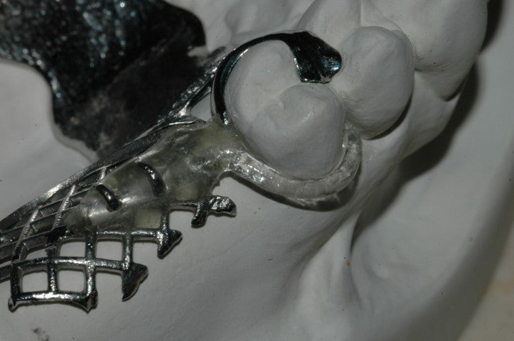 ITSOCLEAR Clasp (6/PKG) Wire and Clasps by Itsoclear- Unique Dental Supply Inc.
