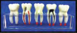 Study Model - M3 Study Models by META DENTAL- Unique Dental Supply Inc.