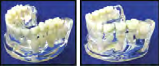 Study Model - M5 Study Models by META DENTAL- Unique Dental Supply Inc.