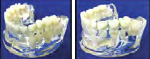 Study Model - M7 Study Models by META DENTAL- Unique Dental Supply Inc.