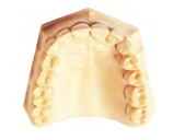 Stone for Models - Hydrocal Gypsum & Accessories by Metro Dent- Unique Dental Supply Inc.