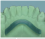 Al Dente-Wax Lingual Bar Wax Patterns by al dente- Unique Dental Supply Inc.
