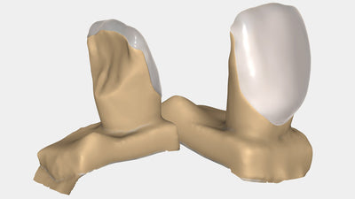 exocad - Dental CAD Software exocad by exocad- Unique Dental Supply Inc.