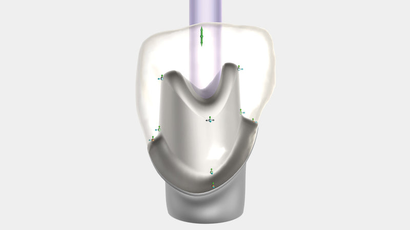 exocad - Implant Add On Module exocad by exocad- Unique Dental Supply Inc.
