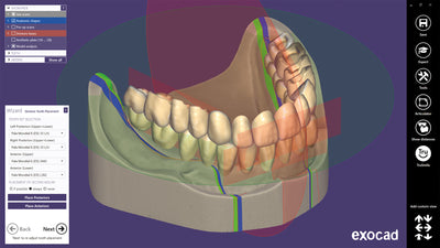 exocad - Full Denture Add On Module exocad by exocad- Unique Dental Supply Inc.